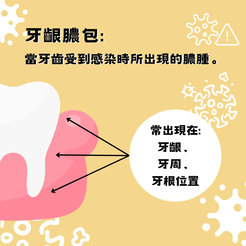 牙齦膿包可能出現的位置