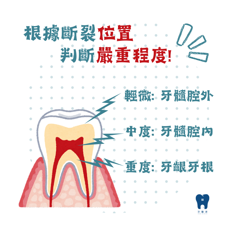 根據斷裂位置判斷嚴重程度