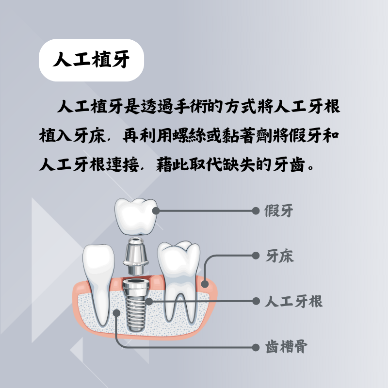 人工植牙