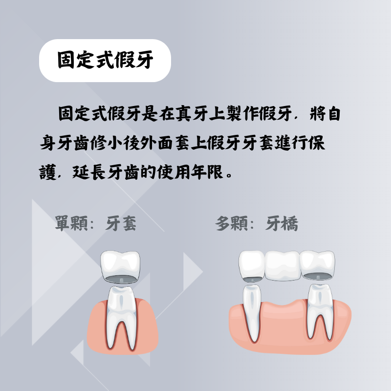固定式假牙